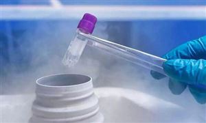 國家衛(wèi)健委答復(fù)為何單身女性不可凍卵 2021輔助生殖行業(yè)發(fā)展現(xiàn)狀與前景分析