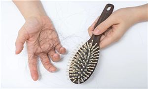 年輕人脫發(fā)的4個(gè)主要原因 防脫生發(fā)洗發(fā)水哪個(gè)牌子好 防脫生發(fā)洗發(fā)水推薦