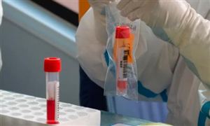 多地通知11月起核酸檢測要收費 新冠疫情推動分子診斷市場爆發(fā)性增長