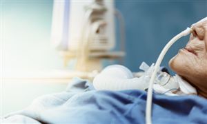 睡眠呼吸機行業(yè)調研 睡眠呼吸機行業(yè)前景展望