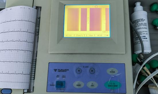 2023心電監(jiān)護儀行業(yè)報告 心電監(jiān)護儀行業(yè)市場現(xiàn)狀調(diào)研及發(fā)展前景研究