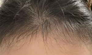 生發(fā)育發(fā)產(chǎn)品市場需求 生發(fā)育發(fā)行業(yè)發(fā)展前景投資分析2023