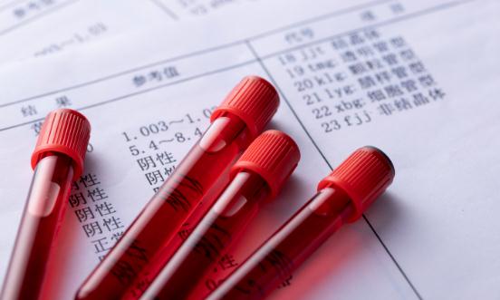 血液制品產(chǎn)業(yè)前景展望 未來行業(yè)的集中度會進一步提高
