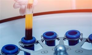 2025酶制劑行業(yè)行業(yè)發(fā)展現(xiàn)狀與產(chǎn)業(yè)鏈分析