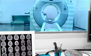 2025年醫(yī)學影像設備產(chǎn)業(yè)深度調(diào)研及未來發(fā)展現(xiàn)狀趨勢預測